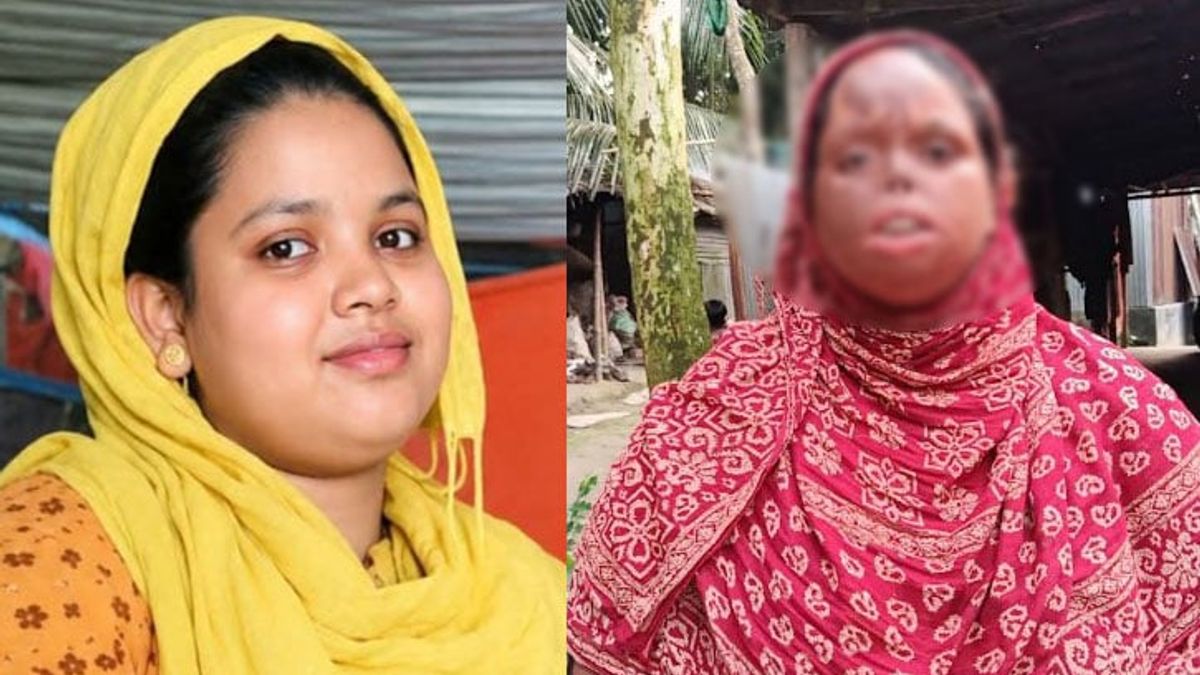 প্রেমের বিয়ের ১০ বছর পর পোড়া মুখে বিচ্ছেদের ক্ষত